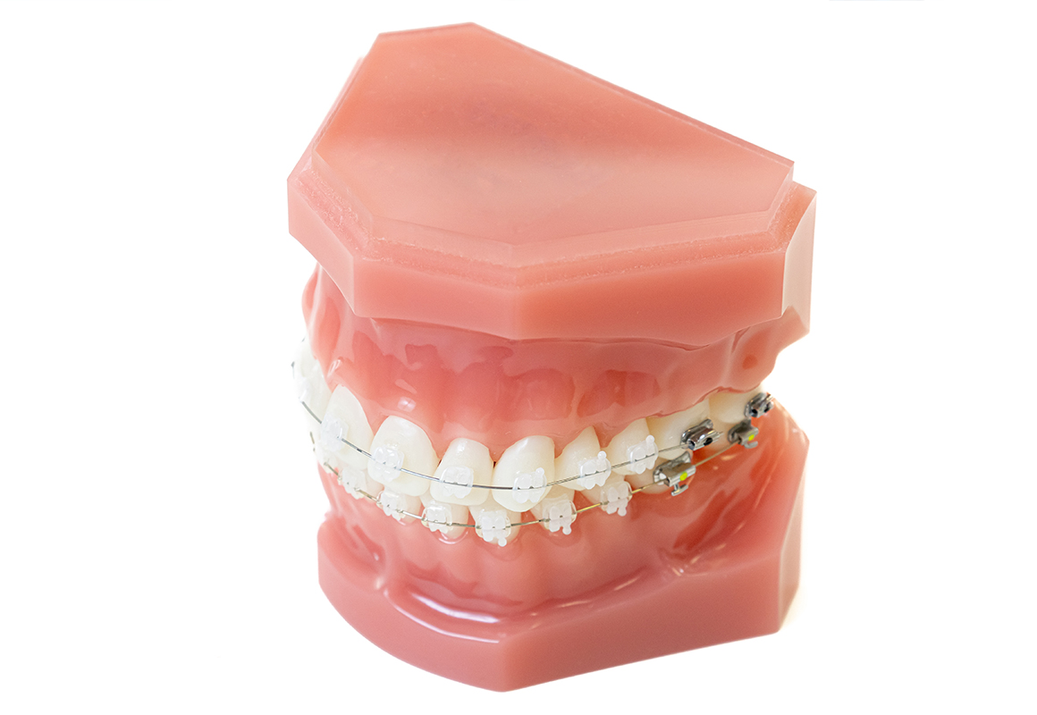 成人矯正の方法