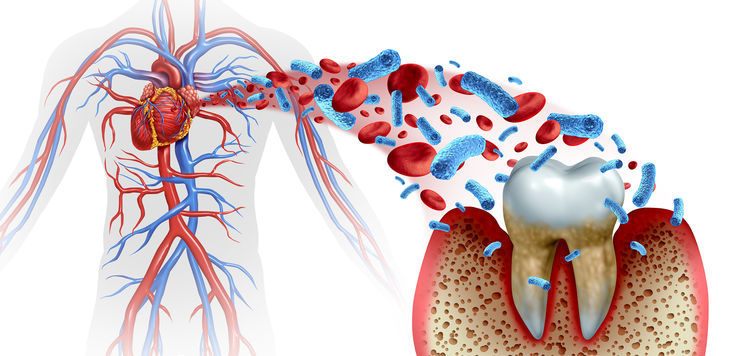 歯周病は全身の健康にも影響します